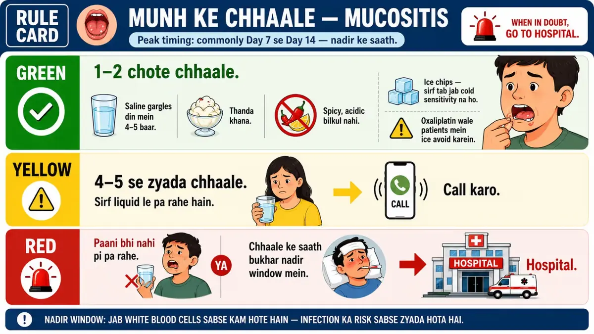 Hindi mucositis and mouth sores rule card for chemotherapy patients. Explains home care for mild ulcers, when to call the doctor for difficulty eating or drinking, and when hospitalization is needed for dehydration or fever.