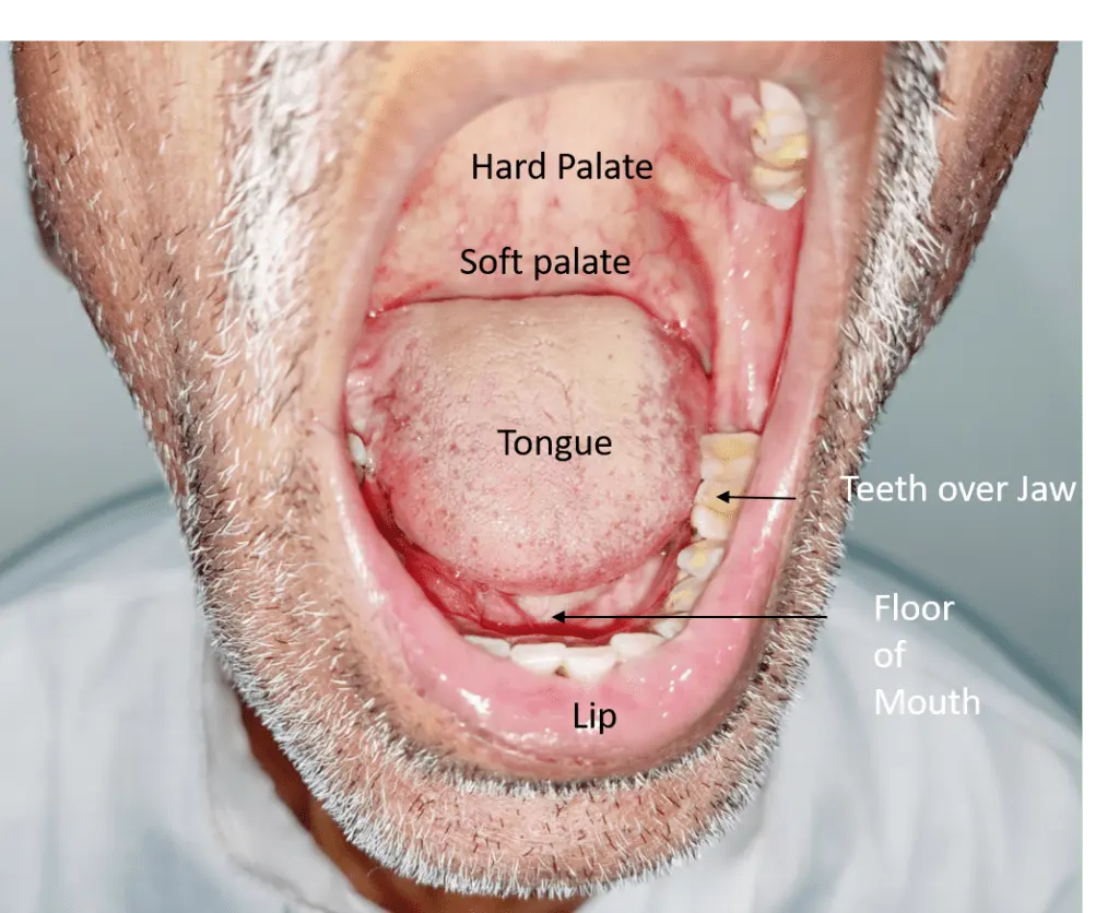 oral cancer doctor in lucknow - cancer specialist in Lucknow | Dr Harshvardhan Atreya
