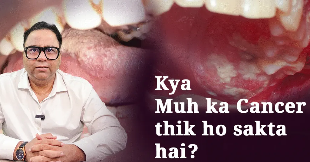 oral cancer doctor in lucknow - cancer specialist in Lucknow | Dr Harshvardhan Atreya