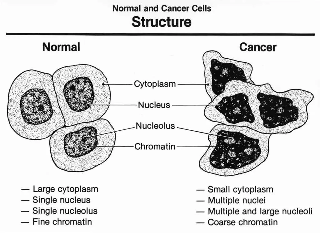 what is cancer: Causes, Treatments & medical oncologist in Lucknow
